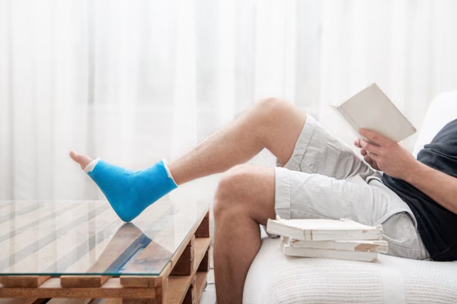 Varicose Veins Naturally—Gentle and Effective Ways That Work